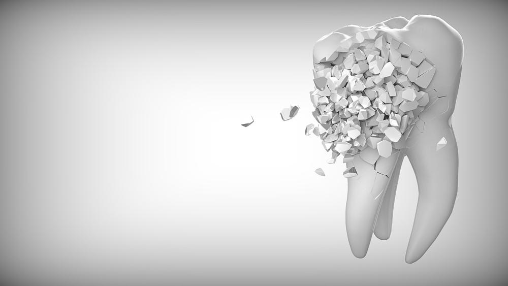 decayed tooth